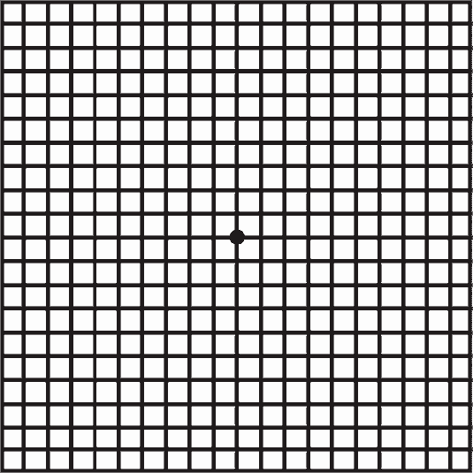 Central Vision and Hearing - This Amsler Grid can help aid in the detection  of Age-Related Macular Degeneration. AMD can cause central vision blurring,  and is not always noticeable. This is why