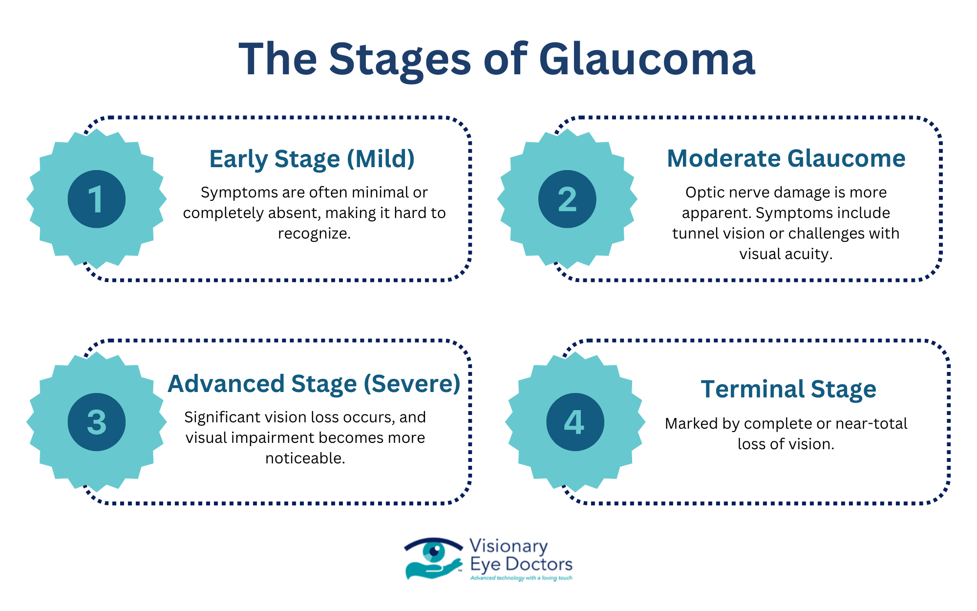 the 4 stages of glaucoma