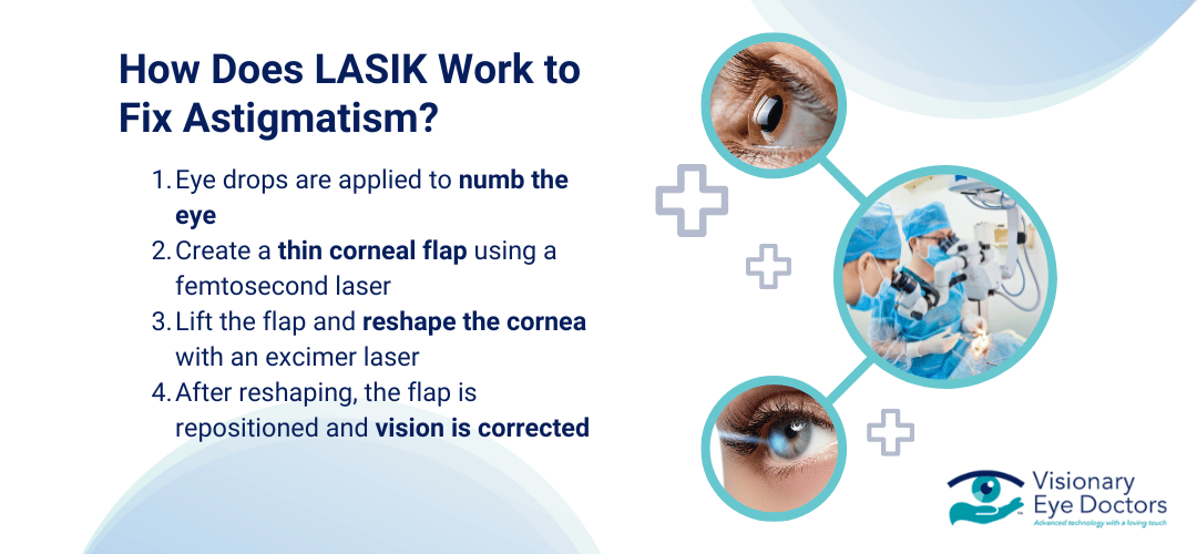 explaining how LASIK works