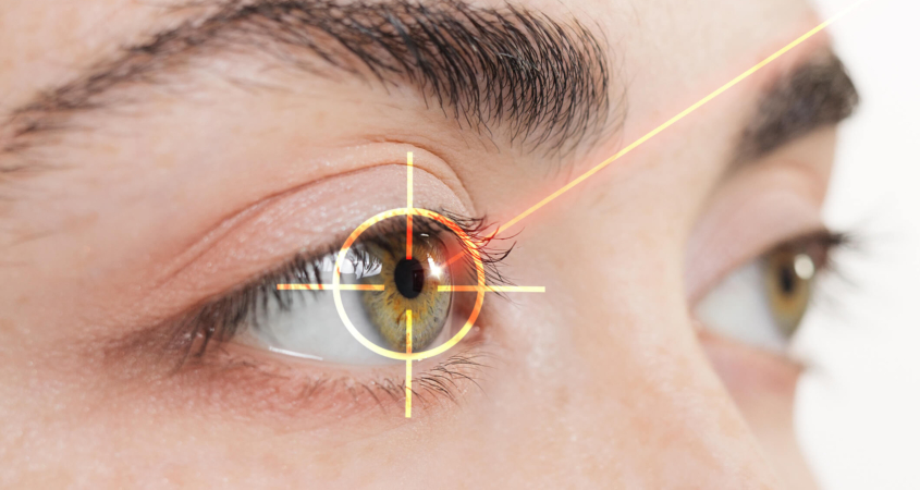 astigmatism in eye